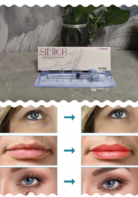 Hautfüller gute Qualität Feamle-Schönheits-Produkt-medizinisches Anti-Altern Derm 2 ml