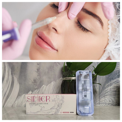 Überschneidbares Natriumhyaluronat Gel 1 ml 2 ml Hyaluronsäure-Nasenfüllmittel