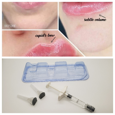 2 ml Cross Linked Dermal Filler hohe Ha-Konzentration 24 mg/ml gegen Falten