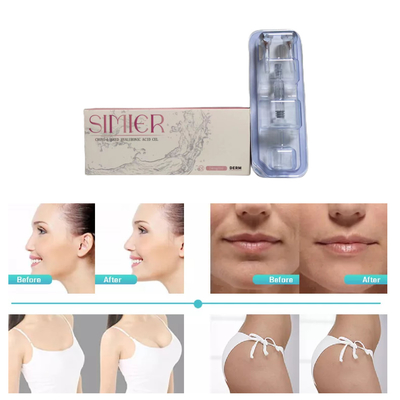 2 ml Cross Linked Dermal Filler hohe Ha-Konzentration 24 mg/ml gegen Falten