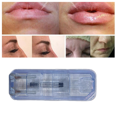 Injektionsmittel mit Ha-Hyaluronsäure Lippenfüllmittel 24 mg/ml Gesichtspflege