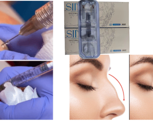 Hyaluronsäure Gesichtsinjektion Lippenfiller für die Haut CE MSDS ISO