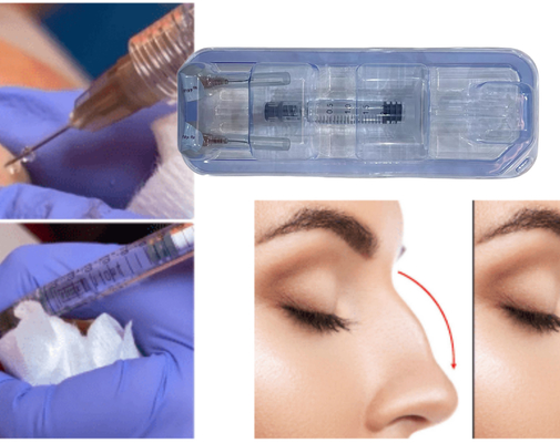 FDA genehmigt Injektions-Hyaluronsäure-Gel für Gesäß