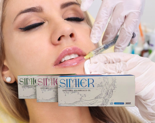 Cross Linked 5ml 30mg/Ml Hyaluronsäure-Injektion zum Kinn