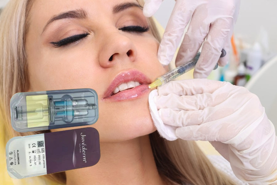 Füllstoffe Hyaluronsäure Gel 5 ml Lippenfiller Injektionen Injektionsfiller