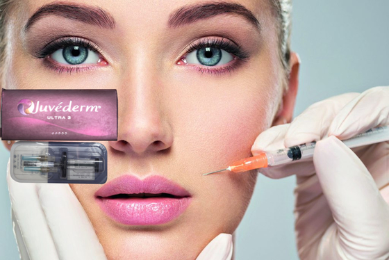1 ml Juvederm Medical Natriumhyaluronat Gel Hyaluronsäure Gel Injektion für die Nasenbrücke