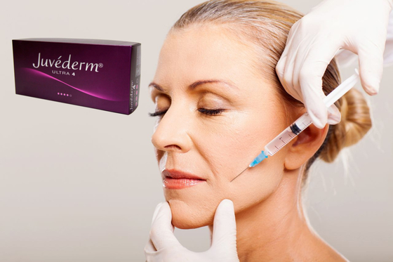 1 ml Juvederm Medical Natriumhyaluronat Gel Hyaluronsäure Gel Injektion für die Nasenbrücke