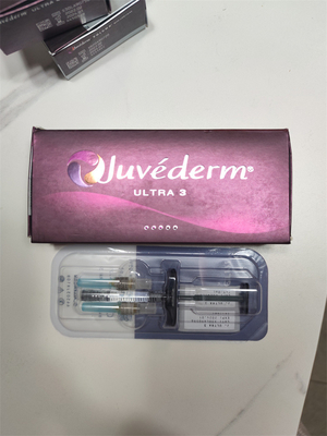 Weiblicher Hyaluronsäure-Füllstoff mit Querverknüpfung Juvederm Lippenfiller Ultra 3 Ultra 4