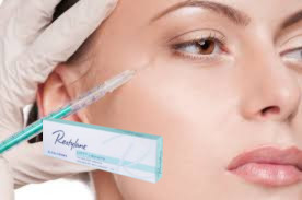27G Marionette Lines Hyaluronsäure-Füllstoff 1ml Tiefen-Füllstoffe mit Lido