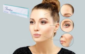 Hyaluronsäure-Füllstoff für die Haut 1x1.1 ml Lippenfiller
