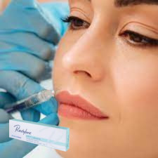 Hyaluronsäure Injektionsmittel Hautfüllmittel Injektionsgel für Lippen