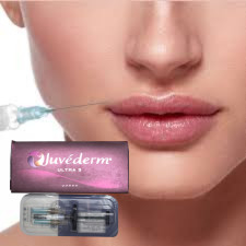 Hyaluronsäure Hautfüllmittel Lippeninjektionen Juvederm Ultra3 Ultra4 Voluma