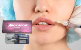 1 ml / Packung Injektionsfiller für Lippen, Kinn, Wangen, Kreuzverknüpfte HA-Füllung