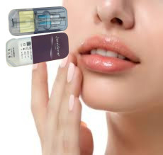 2 X 1 ml Juvederm Ultra 4 Injektionsmittel mit Füllstoff für die Haut
