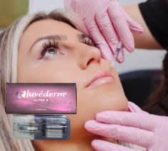 2x1ml HA Dermal Filler Scheibenbein Kinn Kontur Injektionen