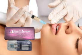 2x1ml HA Dermal Filler Scheibenbein Kinn Kontur Injektionen