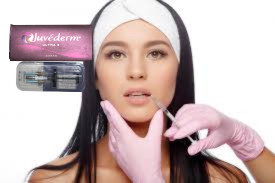 Juvederm Ultra 3 Ultra 4 Hyaluronsäure-Füllstoff zur Lippenvergrößerung