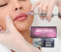 2 X 1 ml Juvederm Ultra 4 Injektionsmittel mit Füllstoff für die Haut