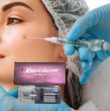 Ultra3 Injektionsgel mit Hyaluronsäure Juvederm Hautfüllmittel für Lippenfüllmittel