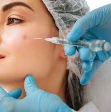 Glatte Falten Injektierbares Hautfüllmittel Hyaluronsäure Juvederm Ultra 3 2*1ml
